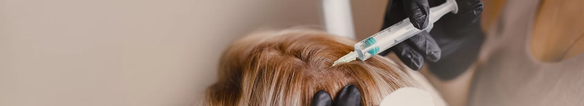 Mesotherapy of the scalp
