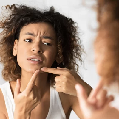 Blackhead extraction