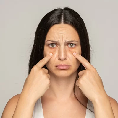 Bags under the eyes - the cause