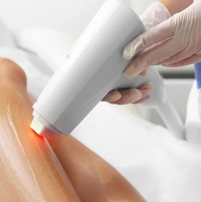 Laser hair removal: how to prepare?