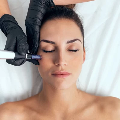 Needle mesotherapy: how many treatments to perform?