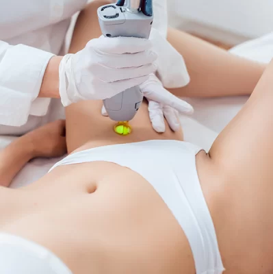 Intimate area hair removal