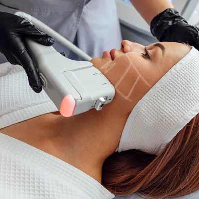 HIFU procedure - what is it?