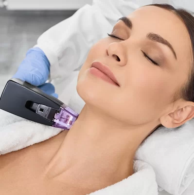 Radiofrequency microneedling - what is it?