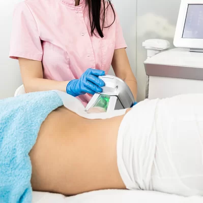 Is cryolipolysis effective?