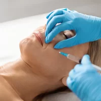 Smile lines around the mouth