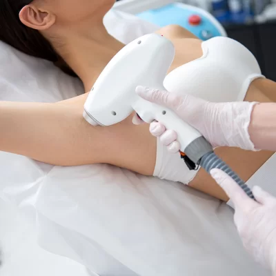 Laser hair removal - how long does it last?