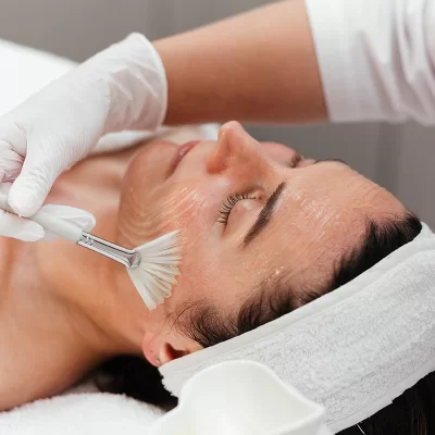 Why is it worth doing peels?