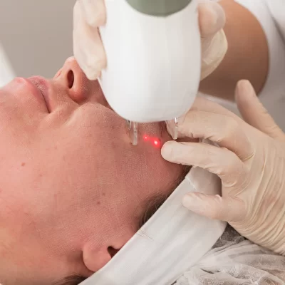 How to speed up healing after fractional laser treatment?