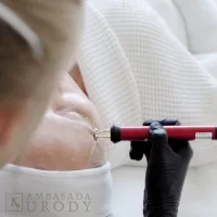 Opadająca powieka - przyczyny
