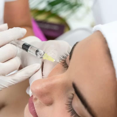 Carboxytherapy for under-eye area