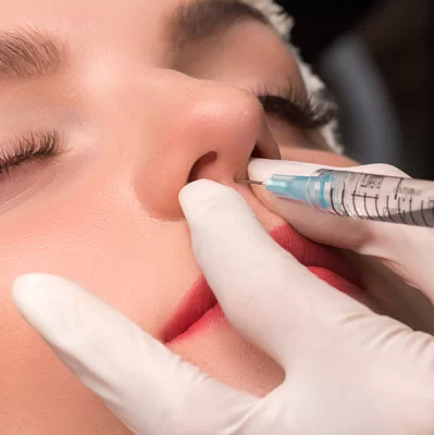 What is a nose correction with hyaluronic acid?