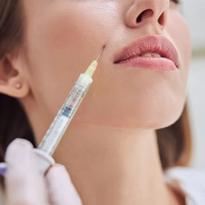 Hyaluronic acid