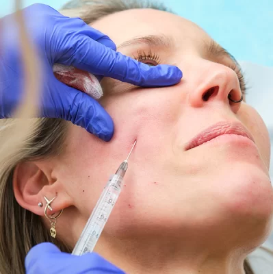 What is hyaluronic acid and how does it work on the cheeks?