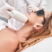 Fractional laser - effects