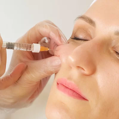 What is mesotherapy with hyaluronic acid?