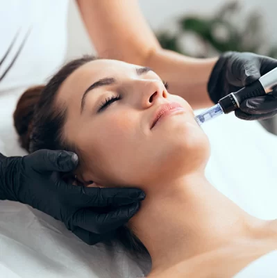 What is microneedling mesotherapy?