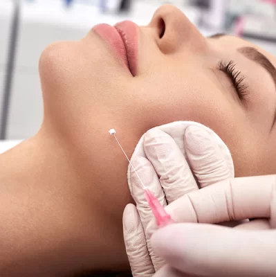 How do Aptos lifting threads work on the chin?