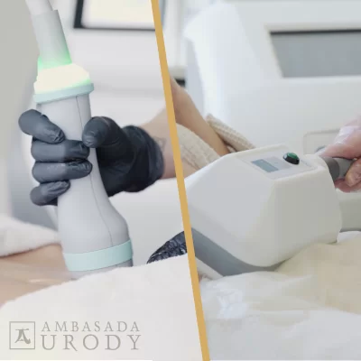 ONDA and Cryolipolysis - when is the best time to perform them?