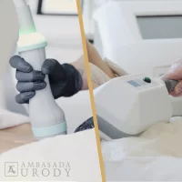 ONDA and Cryolipolysis - when is the best time to perform them?