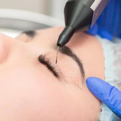 Drooping eyelid