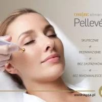 Termolifting Pelleve