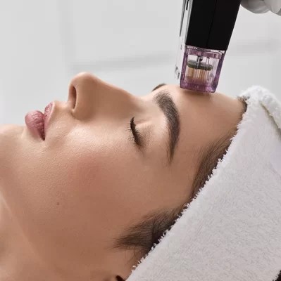 What is microneedle radiofrequency?