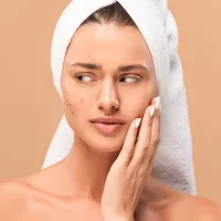 Types of acne