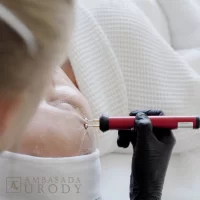 Technologia NASA w medycynie estetycznej? Poznaj BeautyTek