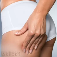Can laser firm the body?