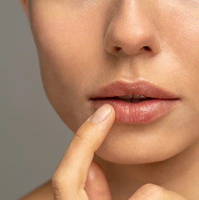 Dry lips in summer - is moisturizing with hyaluronic acid a good solution?