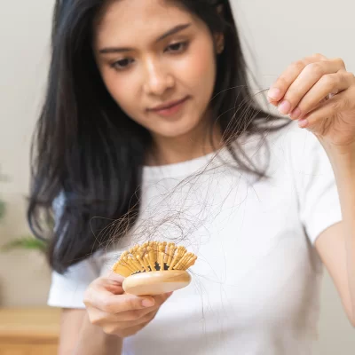 Postpartum hair loss