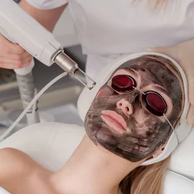 CARBON PEEL