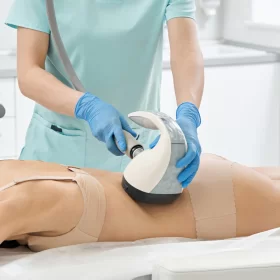 VELASHAPE III