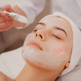 ROSACEA