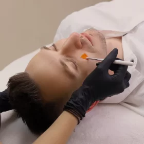 ENLARGED PORES