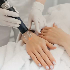 HAND REJUVENATION