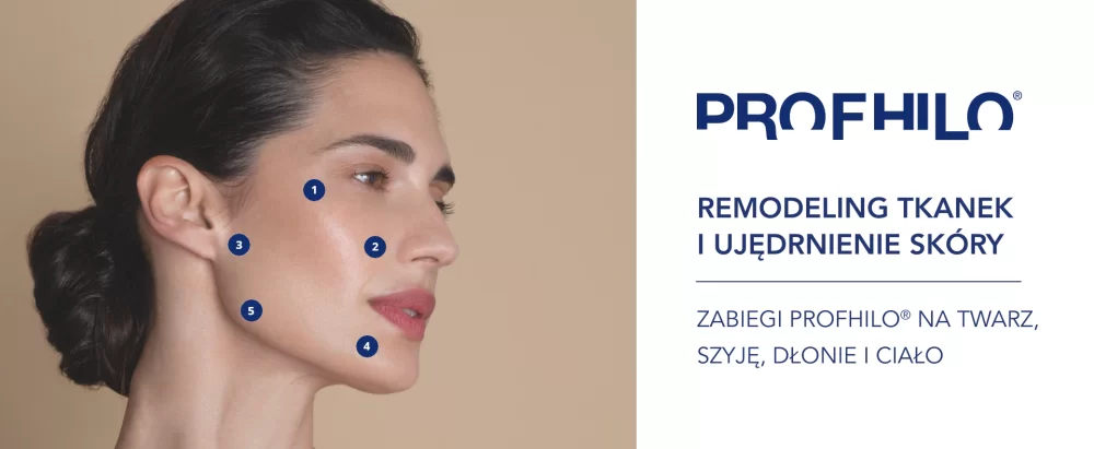 Profhilo is injected into specific anatomical points.