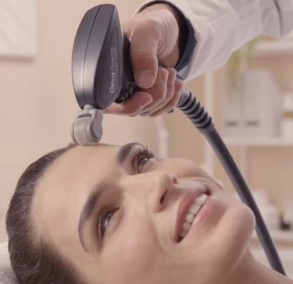 Radiofrequency microneedling -30%