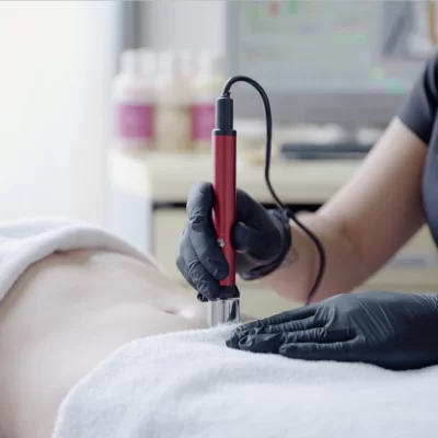 BeautyTek - breast biolifting - 6-session series -10% - 10-session series -20%