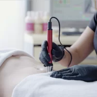 BeautyTek - breast biolifting - 6-session series -10% - 10-session series -20%