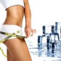 Cryolipolysis - standard applicators -30%<br>Freezing of fatty tissue