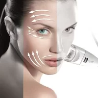 Endermologie Alliance face <br>Package of 6 treatments -13% <br>Package of 10 treatments -26%