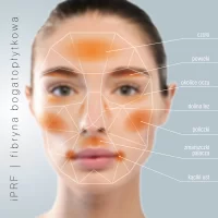 Platelet-rich plasma + fibrinogen up to -40%