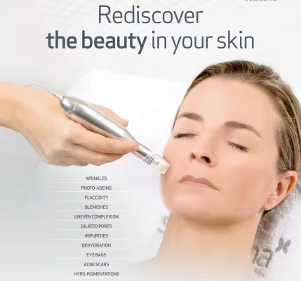 Microneedling mesotherapy with acids and growth factors -20%