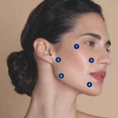 Facial profileoplasty and bioremodeling -20%