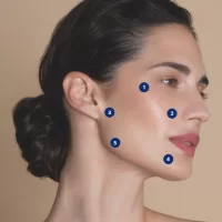 Facial profileoplasty and bioremodeling -20%