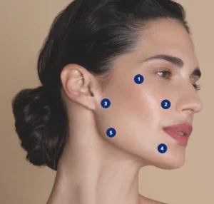 Facial profileoplasty and bioremodeling -50%