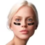 Tear trough correction <br>Elimination of under-eye shadows