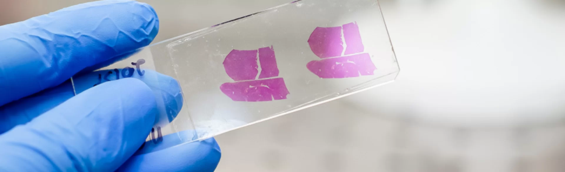 Histopathological examination